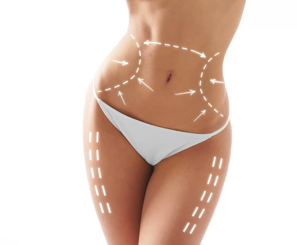 Clinica chirurgie plastica Craiova - lifting, liposuctie - Dr Razvan Mercut