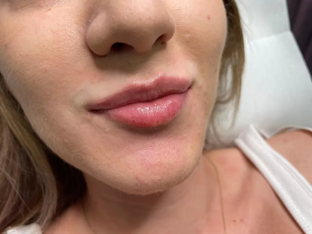 rezultate chirurgie plastica