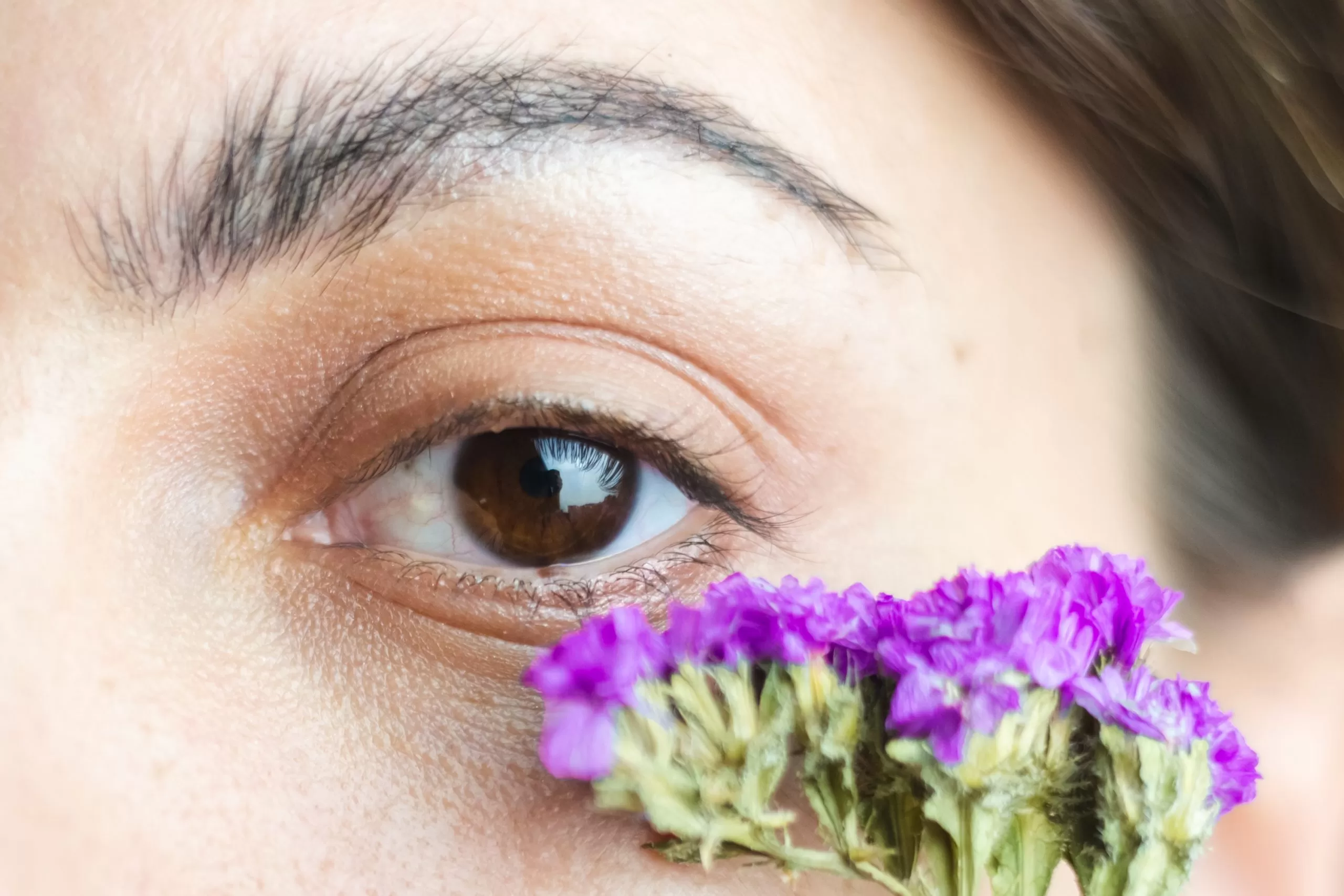 injectare acid hialuronic cearcane