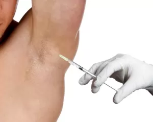 botox transpiratie excesiva