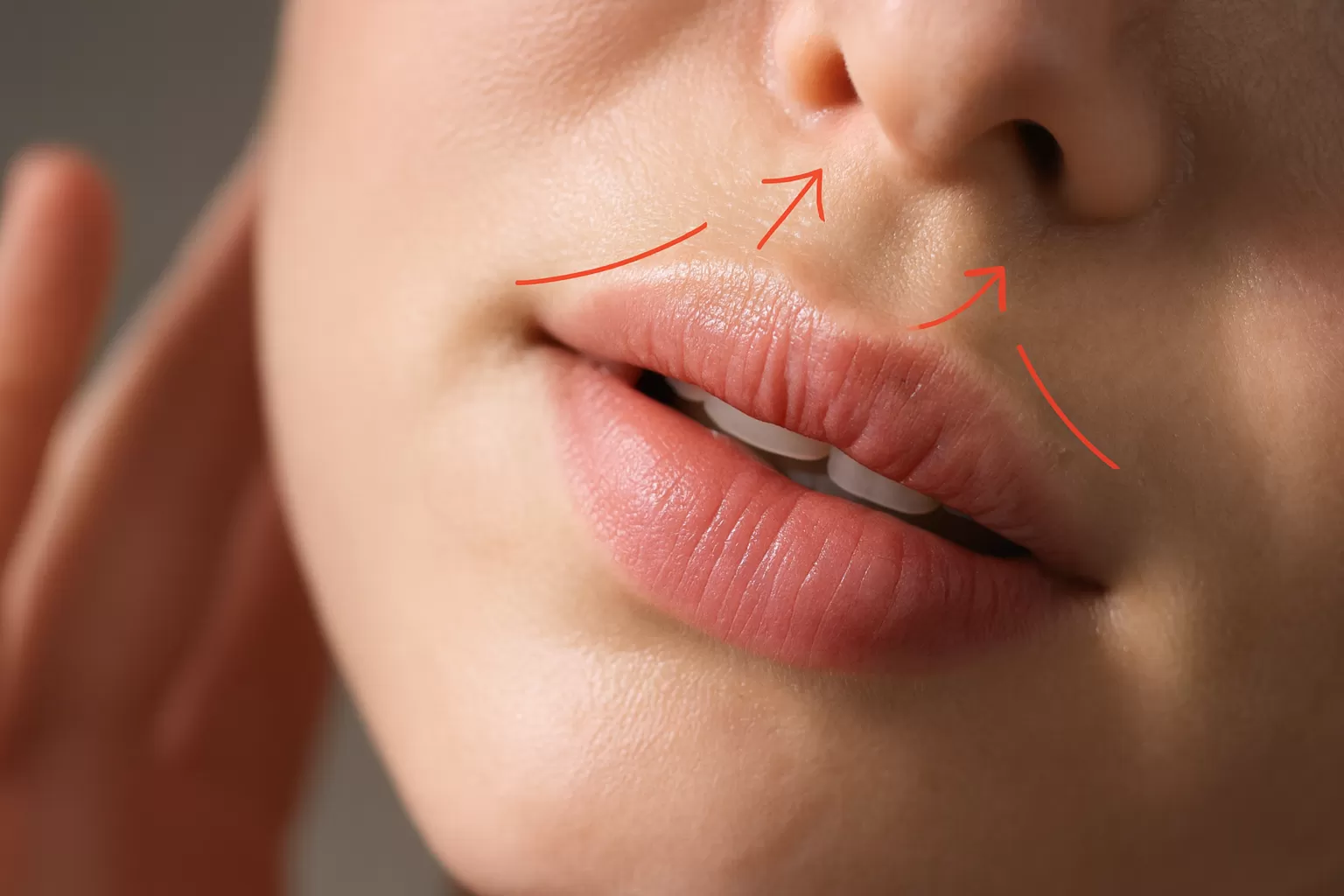 Lip Lift – ce este, cine este candidatul potrivit și cum decurge recuperarea
