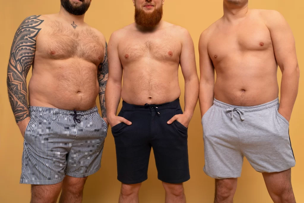 De ce aleg bărbații liposucția și cum se desfășoară intervenția