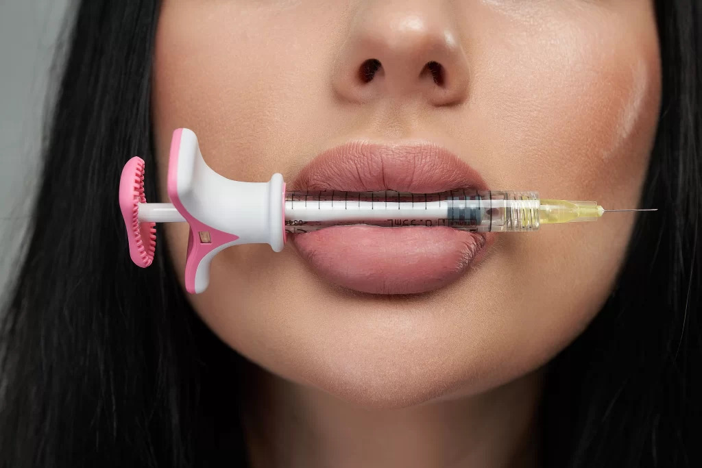 De ce apar gâlmele după acid hialuronic și cum le tratezi