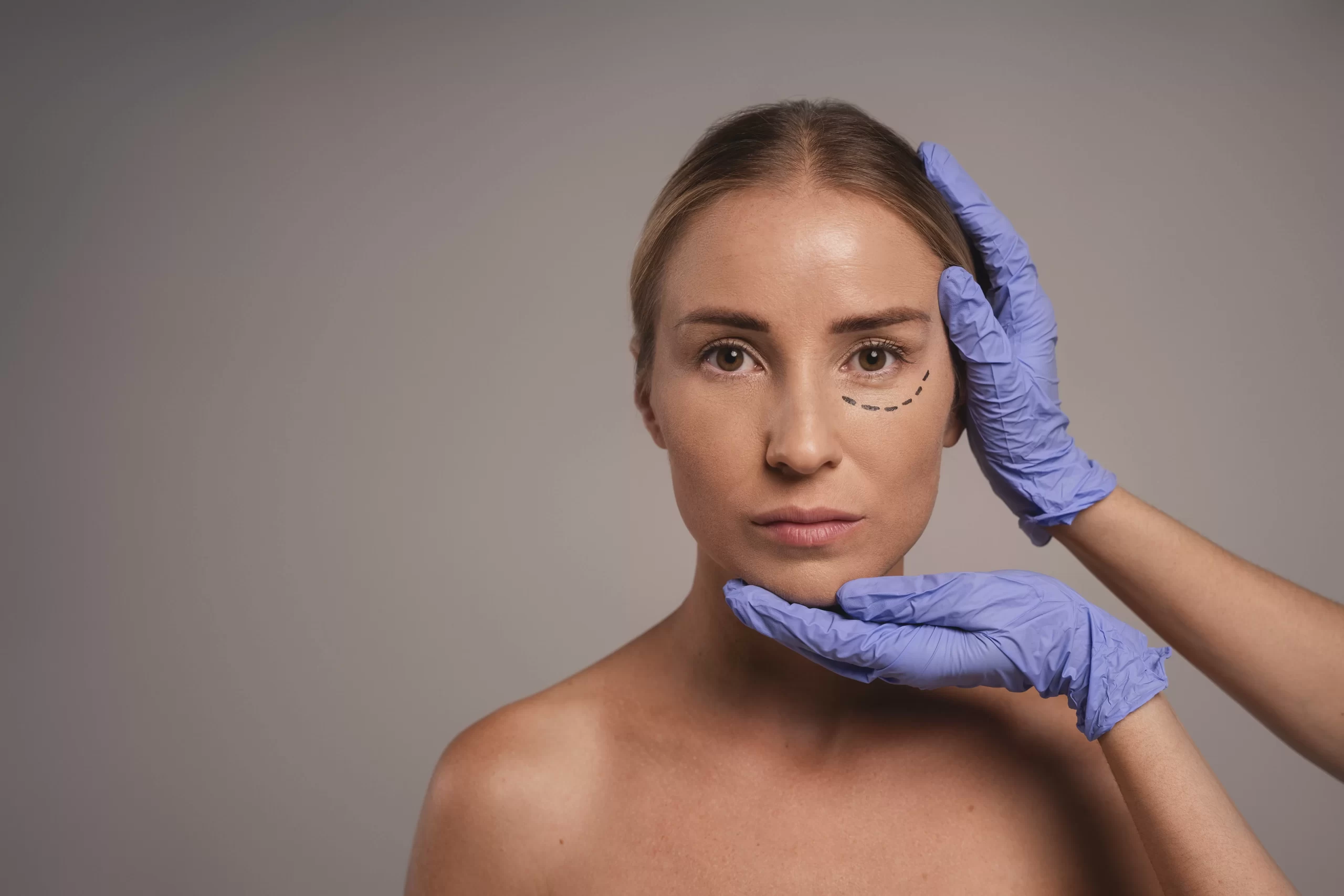 blefaroplastia nechirurgicala