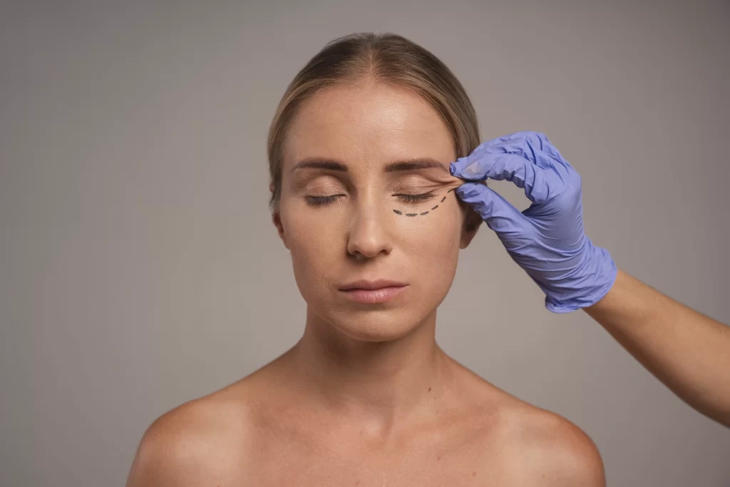 femeie pregatita de blefaroplastie