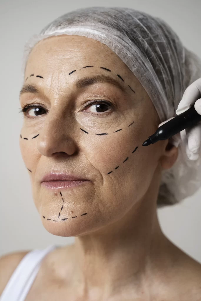 lifting facial in Craiova